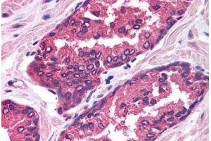 Human Prostate (formalin-fixed, paraffin-embedded) stained with FOXP2 antibody ABIN214758 at 2. (FOXP2 抗体  (AA 71-120))