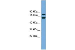 WB Suggested Anti-YY1AP1 Antibody Titration:  0.