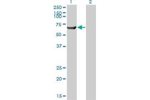 Western Blot analysis of TRIM16 expression in transfected 293T cell line by TRIM16 monoclonal antibody (M01), clone 5F4. (TRIM16 抗体  (AA 165-273))