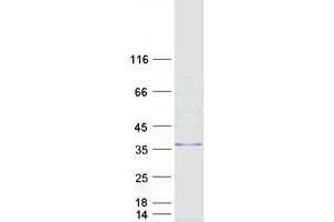 Western Blotting (WB) image for Membrane-Associated Ring Finger (C3HC4) 8, E3 Ubiquitin Protein Ligase (MARCH8) (Transcript Variant 7) protein (Myc-DYKDDDDK Tag) (ABIN2725494)