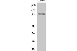 Western Blotting (WB) image for anti-Forkhead Box O3 (FOXO3) (Ser253) antibody (ABIN5958398) (FOXO3 抗体  (Ser253))