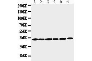 Anti-Cyclin D1 antibody,  Western blotting Lane 1: Rat Testis Tissue Lysate Lane 2: Rat Ovary Tissue Lysate Lane 3: Rat Brain Tissue Lysate Lane 4: HELA Cell Lysate Lane 5: MM231 Cell Lysate Lane 6: SW620 Cell Lysate (Cyclin D1 抗体  (C-Term))