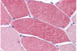 Human Skeletal Muscle: Formalin-Fixed, Paraffin-Embedded (FFPE) (LRRC19 抗体  (C-Term))
