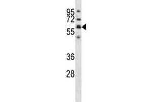 GPC3 antibody western blot analysis in NCI-H292 lysate. (Glypican 3 抗体  (AA 465-494))
