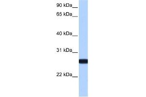 IL13RA2 antibody used at 1 ug/ml to detect target protein. (IL13RA2 抗体  (N-Term))