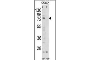 Western blot analysis of FLCN Antibody Pab pre-incubated without(lane 1) and with(lane 2) blocking peptide in K562 cell line lysate (FLCN 抗体  (C-Term))