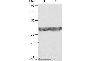 Western blot analysis of A549 and hela cell, using ALDOA Polyclonal Antibody at dilution of 1:500 (ALDOA 抗体)