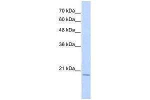 RBM39 antibody used at 1 ug/ml to detect target protein.