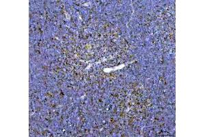 IHC analysis of ARID1A using anti-ARID1A antibody (ABIN7602567).