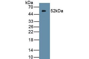 Detection of Recombinant IFNk, Human using Polyclonal Antibody to Interferon Kappa (IFNk) (IFNK 抗体  (AA 28-207))