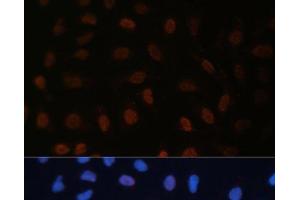 Immunofluorescence analysis of U-2 OS cells using BRD4 Polyclonal Antibody at dilution of 1:100 (40x lens). (BRD4 抗体)