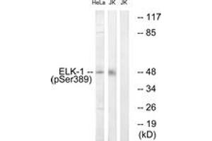 Western Blotting (WB) image for anti-ELK1, Member of ETS Oncogene Family (ELK1) (AA 356-405), (pSer389) antibody (ABIN1531827)