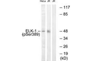 Western blot analysis of extracts from Jurkat cells treated with UV 15' and HeLa cells treated with paclitaxel 1uM 24h, using Elk1 (Phospho-Ser389) Antibody. (ELK1 抗体  (pSer389))