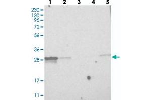 Western blot analysis of Lane 1: RT-4, Lane 2: U-251 MG, Lane 3: Human Plasma, Lane 4: Liver, Lane 5: Tonsil with MITD1 polyclonal antibody  at 1:250-1:500 dilution. (MITD1 抗体)