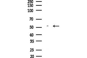 anti-Myotilin (MYOT) (C-Term) antibody