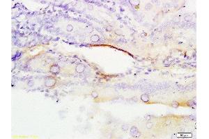 Immunohistochemistry (Paraffin-embedded Sections) (IHC (p)) image for anti-Excision Repair Cross Complementing Polypeptide-1 (ERCC1) (AA 151-250) antibody (ABIN733553)