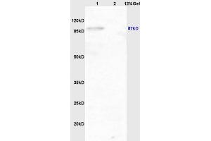 Lane 1: mouse brain lysates Lane 2: mouse lung lysates probed with Anti phospho-IKK beta(Tyr199) Polyclonal Antibody, Unconjugated (ABIN743243) at 1:200 in 4 °C. (IKBKB 抗体  (pTyr199))