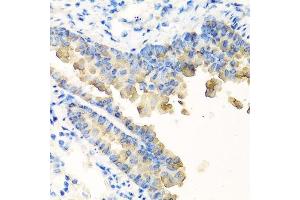 Immunohistochemistry of paraffin-embedded mouse lung using NYX antibody.