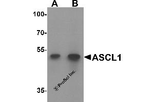 Western Blotting (WB) image for anti-Acyl-CoA Synthetase Long-Chain Family Member 1 (Acsl1) antibody (ABIN1077392)