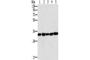 Western Blotting (WB) image for anti-Mitochondrial Carrier 2 (MTCH2) antibody (ABIN2430475)