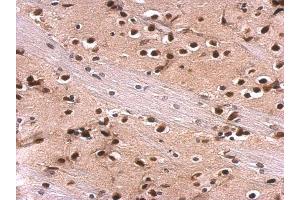 IHC-P Image MEF2A antibody [C2C3], C-term detects MEF2A protein at nucleus on rat fore brain by immunohistochemical analysis. (MEF2A 抗体  (C-Term))