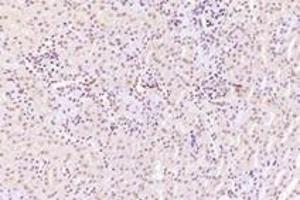 Immunohistochemistry analysis of paraffin-embedded mouse kidney using,RanBP16 (ABIN7073901) at dilution of 1: 2000