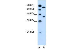 SLCO1A2 antibody used at 0. (SLCO1A2 抗体  (Middle Region))