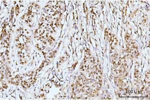IHC analysis of IFI16 using anti-IFI16 antibody (ABIN7600374). (IFI16 抗体  (AA 183-743))
