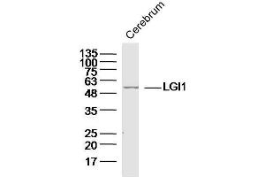 Mouse cerebrum lysates probed with LGI1 Polyclonal Antibody, unconjugated  at 1:300 overnight at 4°C followed by a conjugated secondary antibody at 1:10000 for 90 minutes at 37°C. (LGI1 抗体  (AA 451-557))