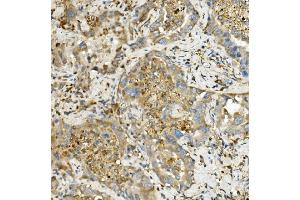 IHC analysis of Hexokinase 1/HK1 using anti-Hexokinase 1/HK1 antibody (ABIN7600258). (Hexokinase 1 抗体  (AA 17-323))