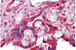 Anti-CDK6 antibody IHC staining of human placenta. (CDK6 抗体)