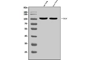 Western blot analysis of PSD95/DLG4 using anti-PSD95/DLG4 antibody (ABIN7600355).