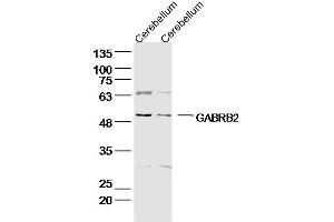 Lane 1: Rat Cerebellum lysates; Lane 2: Mouse Cerebellum lysates; probed with GABRB2/GABA A Receptor beta 2 Polyclonal Antibody, unconjugated (bs-12065R) at 1:300 overnight at 4°C followed by a conjugated secondary antibody for 60 minutes at 37°C.