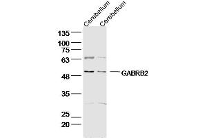Lane 1: Rat Cerebellum lysates; Lane 2: Mouse Cerebellum lysates; probed with GABRB2/GABA A Receptor beta 2 Polyclonal Antibody, unconjugated (bs-12065R) at 1:300 overnight at 4°C followed by a conjugated secondary antibody for 60 minutes at 37°C. (GABRB2 抗体  (AA 251-350))