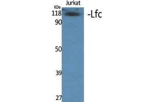 Western Blot (WB) analysis of specific cells using Lfc Polyclonal Antibody. (ARHGEF2 抗体  (Tyr427))