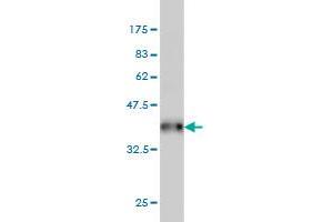 Western Blot detection against Immunogen (38. (ZAK 抗体  (AA 1-120))