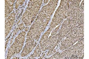 anti-Ataxin 1 (ATXN1) (C-Term) antibody