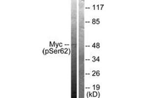 Western blot analysis of extracts from 293 cells treated with Forskolin 40nM 30', using Myc (Phospho-Ser62) Antibody. (c-MYC 抗体  (pSer62))