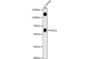 Western blot analysis of extracts of U-87MG cells, using PL antibody (ABIN7269418) at 1:1000 dilution. (PLAG1 抗体  (AA 33-288))