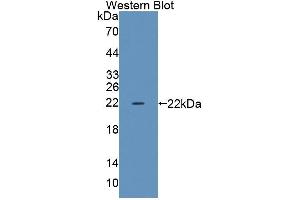 Western blot analysis of the recombinant protein. (TRERF1 抗体  (AA 779-936))