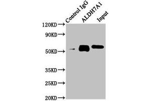 ALDH7A1 抗体  (AA 386-515)