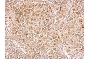 IHC-P Image CIAPIN1 antibody detects CIAPIN1 protein at cytosol on by immunohistochemical analysis. (CIAPIN1 抗体)