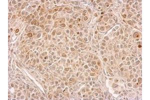 IHC-P Image CIAPIN1 antibody detects CIAPIN1 protein at cytosol on by immunohistochemical analysis. (CIAPIN1 抗体)
