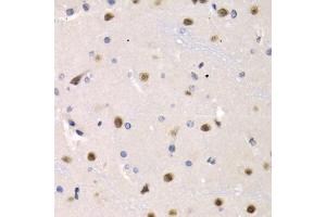 Immunohistochemistry of paraffin-embedded rat brain using IRF2 antibody (ABIN5971383) at dilution of 1/200 (40x lens). (IRF2 抗体)