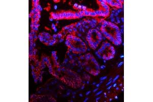 IF analysis of EpCAM using anti-EpCAM antibody (ABIN7600081). (EpCAM 抗体  (AA 147-189))