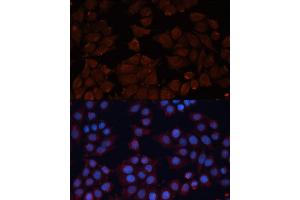 Immunofluorescence (IF) image for anti-ADAM Metallopeptidase Domain 12 (ADAM12) (AA 589-738) antibody (ABIN6136521)