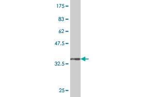 Western Blot detection against Immunogen (33. (LHX5 抗体  (AA 114-182))