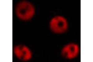 ABIN6267010 staining HepG2 by IF/ICC. (ZNF148 抗体  (N-Term))