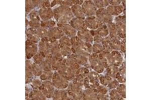 Immunohistochemical staining of human stomach with KATNB1 polyclonal antibody  shows strong cytoplasmic positivity in glandular cells at 1:1000-1:2500 dilution. (KATNB1 抗体)