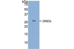 Detection of Recombinant PGA, Human using Polyclonal Antibody to Pepsinogen A (PGA) (Pepsinogen A 抗体  (AA 63-295))